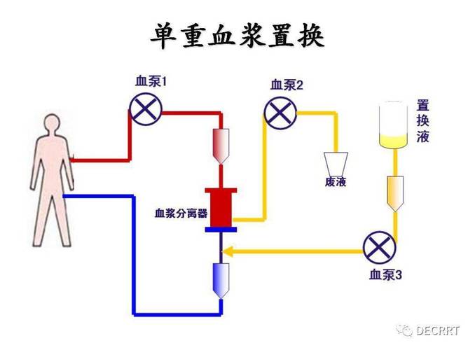 血浆爆裂怎么办？别慌，这里有解决方法！